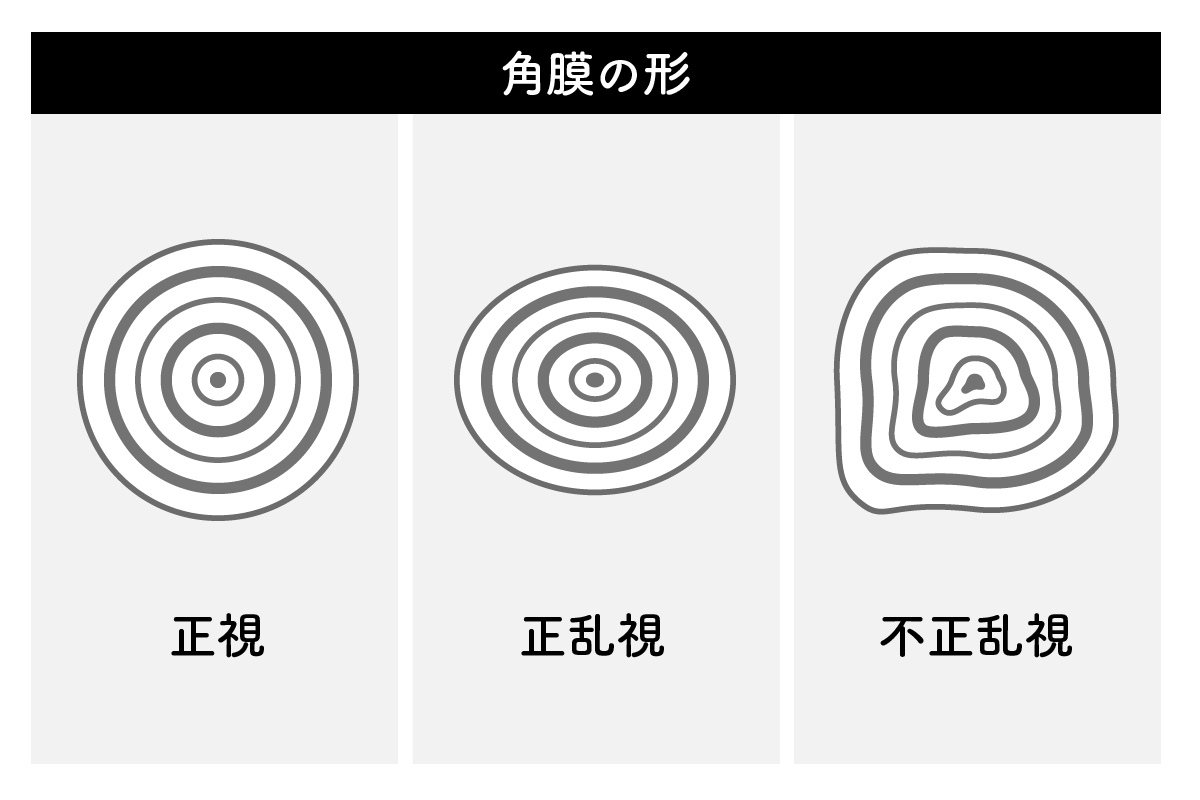 驚きの価格 乱視を見るハンカチ - fonotecanacional.gob.mx